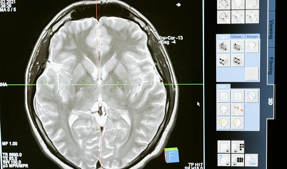 1721473126964Ictus_Est